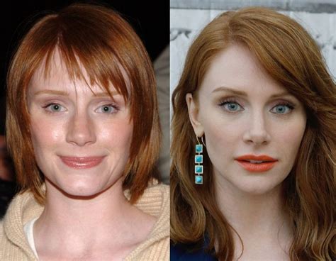 bryce dallas howard surgery.